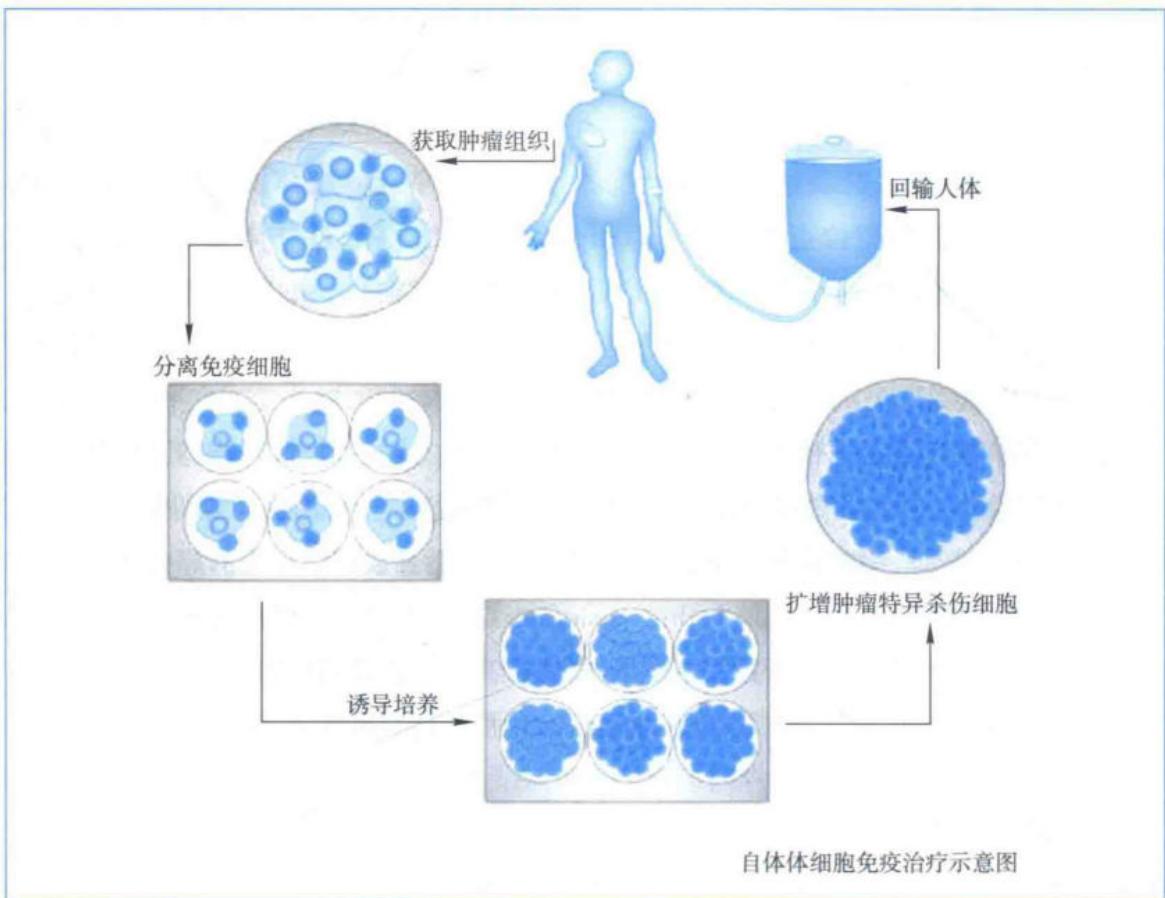 过继性细胞治疗